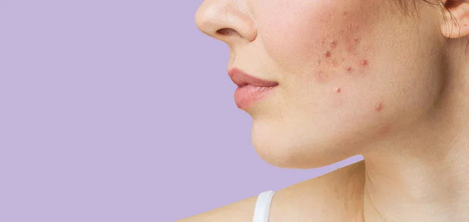 Al momento stai visualizzando CBD e pelle: cosa è stato studiato e come sono regolati i cosmetici